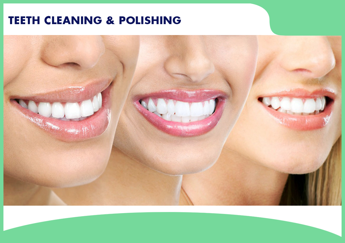 Teeth Cleaning And Polishing