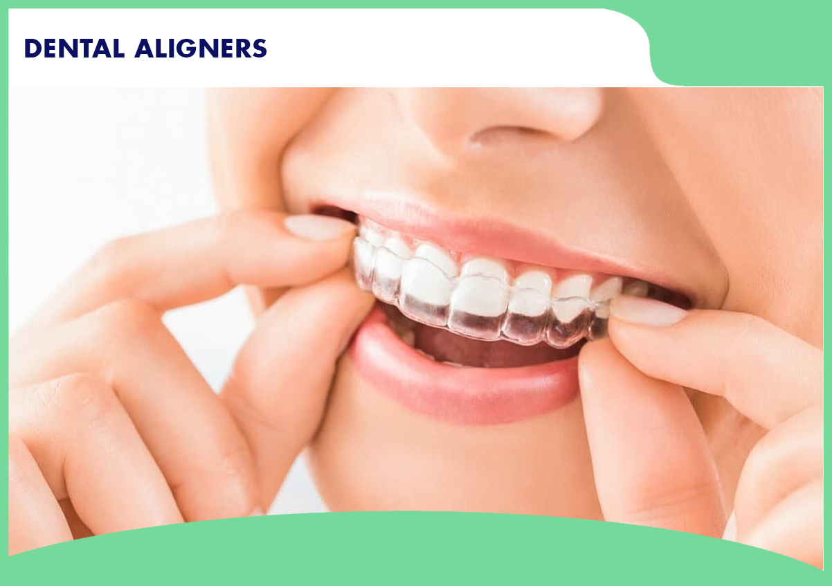 Dental Aligners